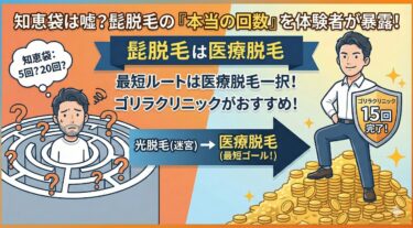 知恵袋は嘘？髭脱毛は何回必要か｜ゴリラクリニックで15回通った私の体験