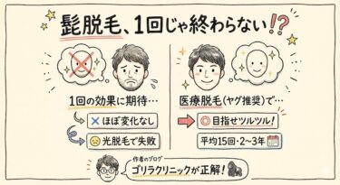 髭脱毛一回の効果は？医療と光の違いや回数目安を失敗談から解説