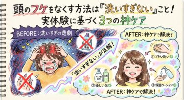 頭のフケをなくす方法は「洗いすぎない」こと！実体験に基づく3つの神ケア