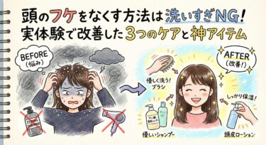 頭のフケをなくす方法は「洗いすぎない」こと！実体験で改善した3つのケアと神アイテム