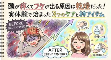 頭が痒くてフケが出る原因は乾燥だった！実体験で治まった3つのケアと神アイテム
