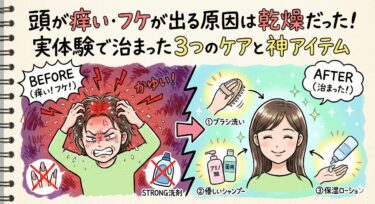 頭が痒い・フケが出る原因は乾燥だった！実体験で治まった3つのケアと神アイテム