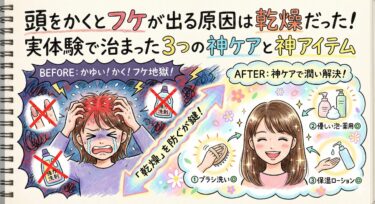 頭をかくとフケが出る原因は乾燥だった！実体験で治まった3つの神ケアと神アイテム