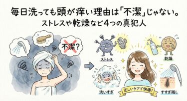 毎日洗っても頭が痒い理由は「不潔」じゃない。ストレスや乾燥など4つの真犯人