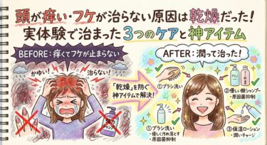 頭のフケを取る方法はコレ！原因の乾燥を防いで改善した3つの神アイテム